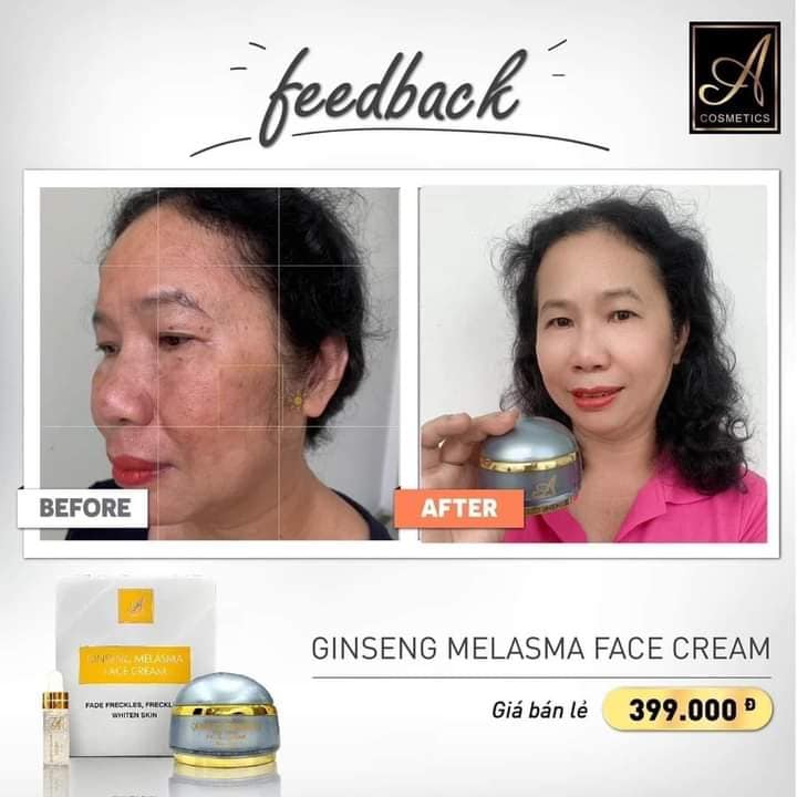 Kem face nám nhân sâm A Cosmetics Phương Anh